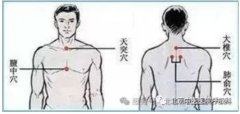 
咳喘、关节痛、总怕冷？三伏贴的关键知识